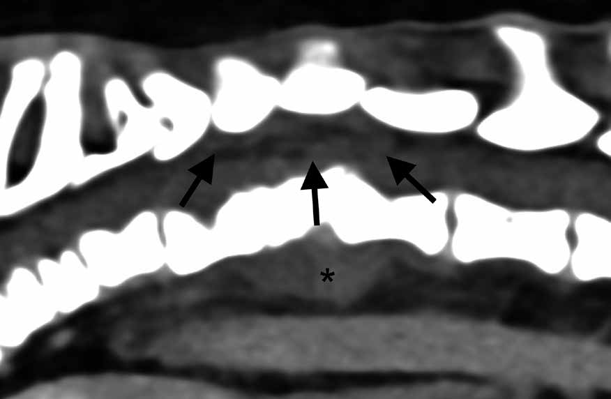 Sagittal reformatiertes CT-Bild nach intravenöser Kontrastmittelgabe.